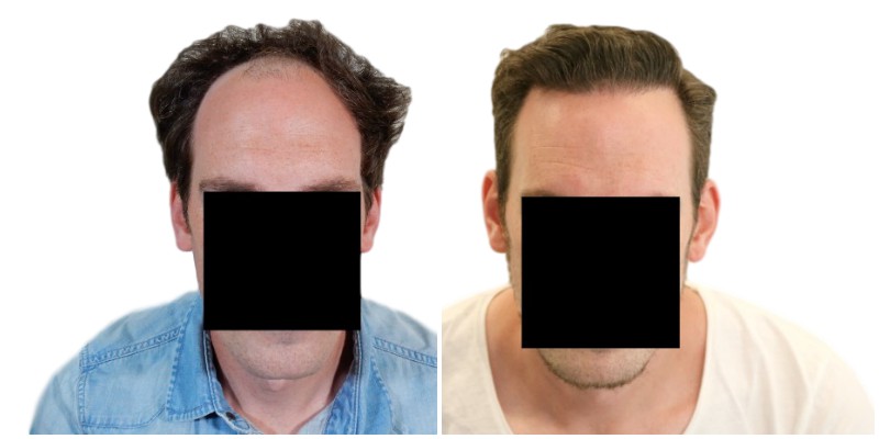 /fud/index.php/fa/26377/0/