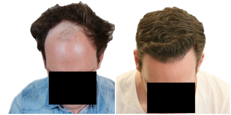 /fud/index.php/fa/26378/0/