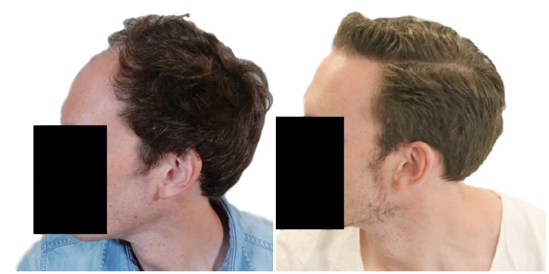 /fud/index.php/fa/26379/0/