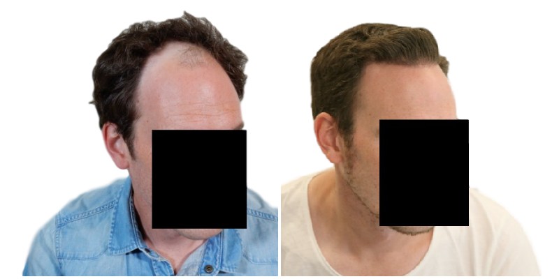 /fud/index.php/fa/26380/0/