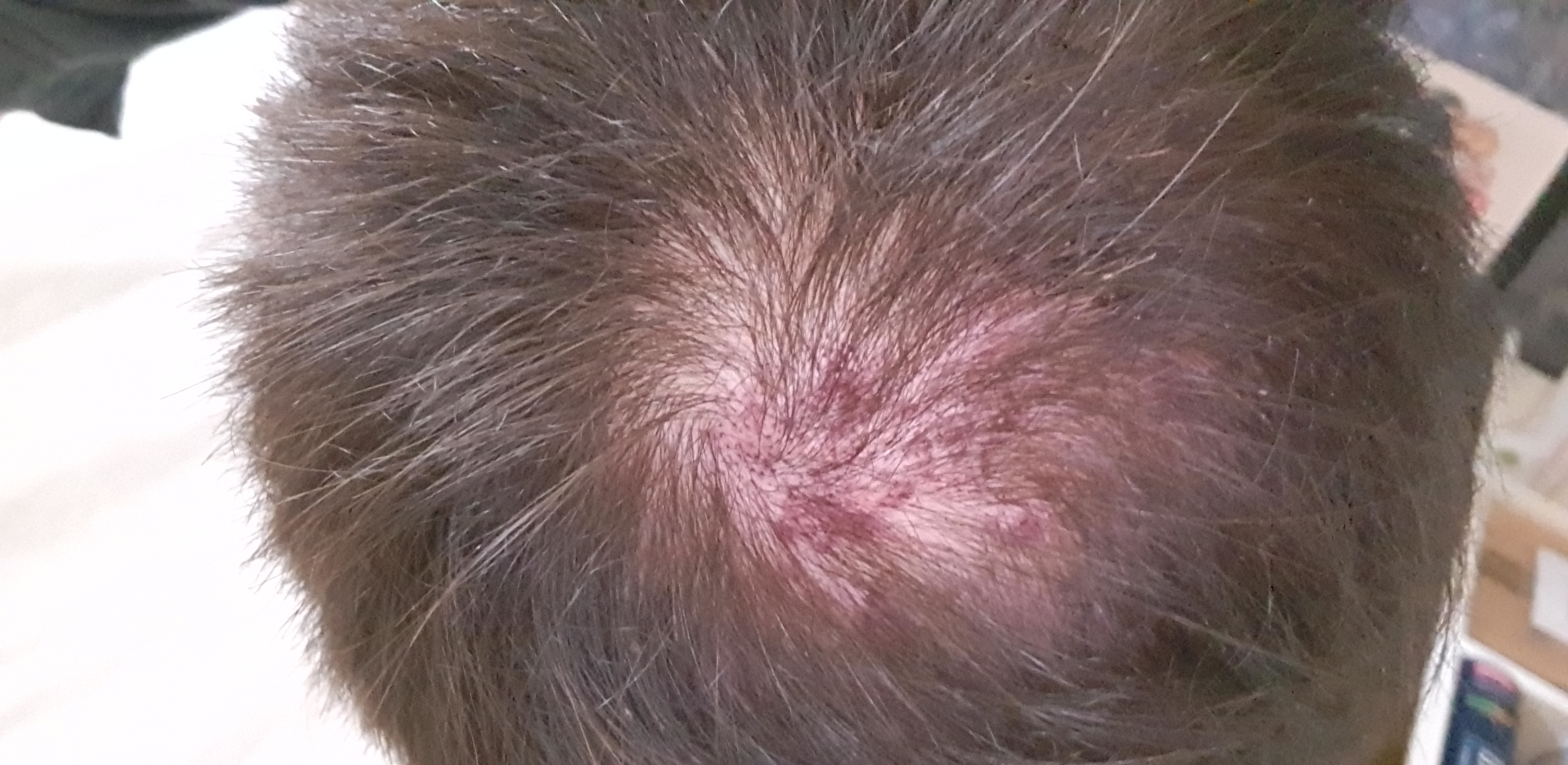 /fud/index.php/fa/27532/0/