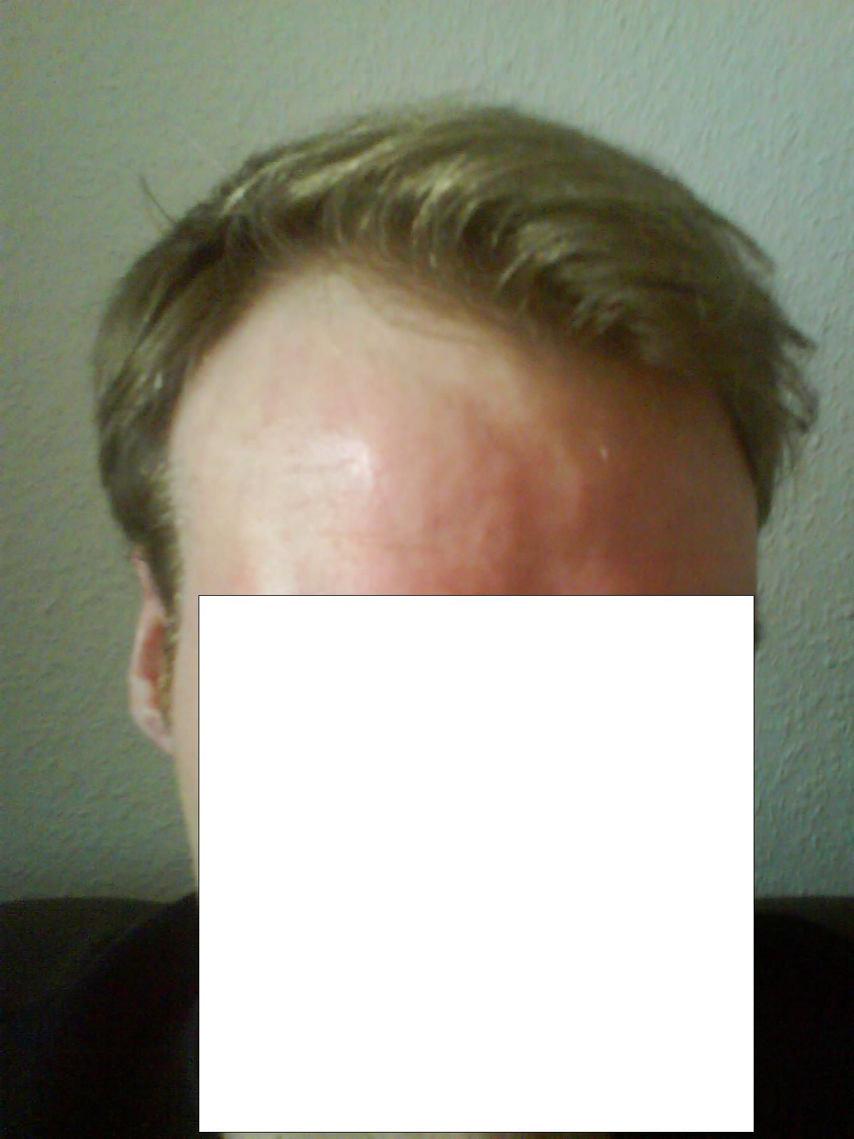 index.php/fa/2777/0/