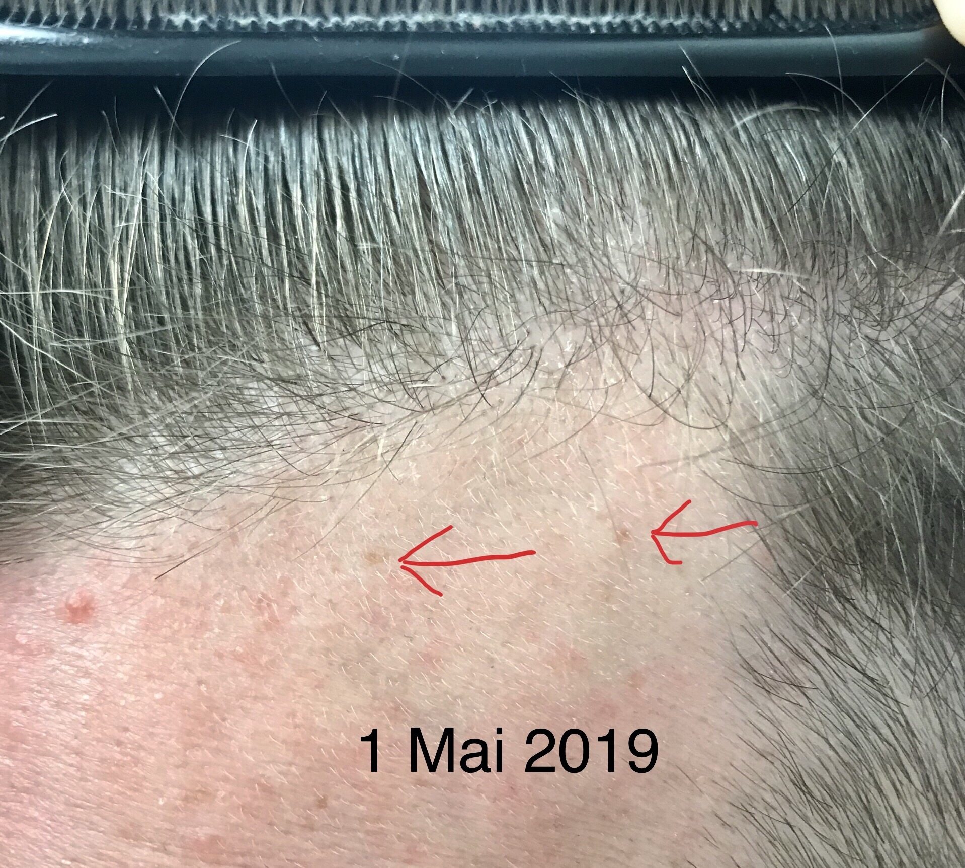 /fud/index.php/fa/28268/0/