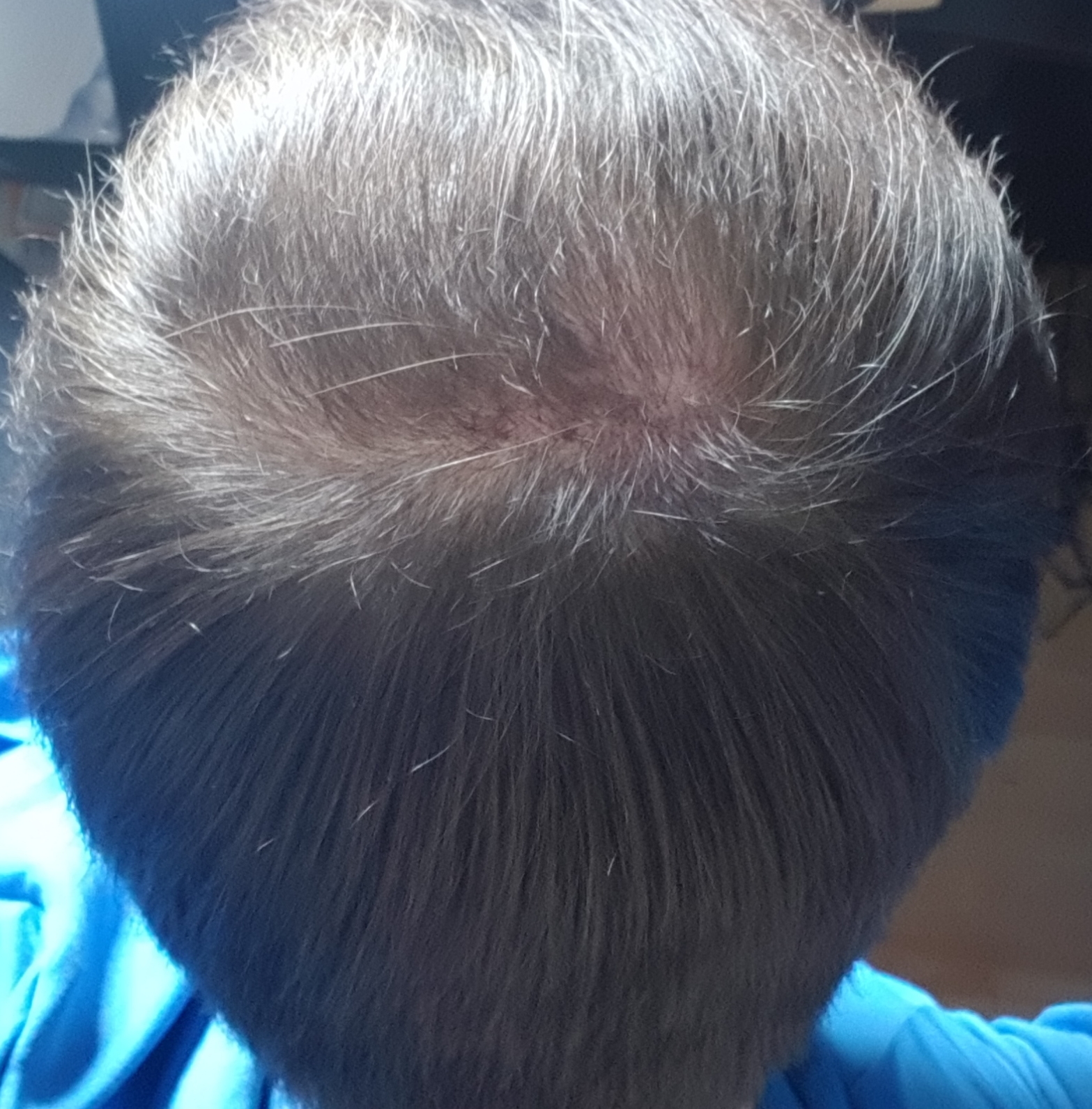 /fud/index.php/fa/28442/0/