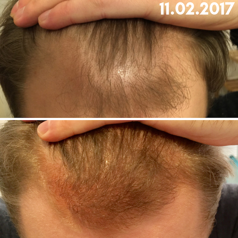 /fud/index.php/fa/28646/0/