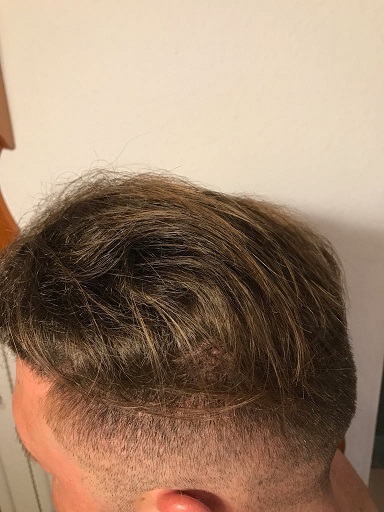 /fud/index.php/fa/28807/0/