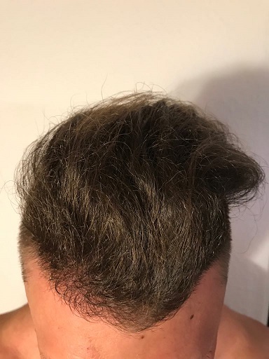 /fud/index.php/fa/28808/0/