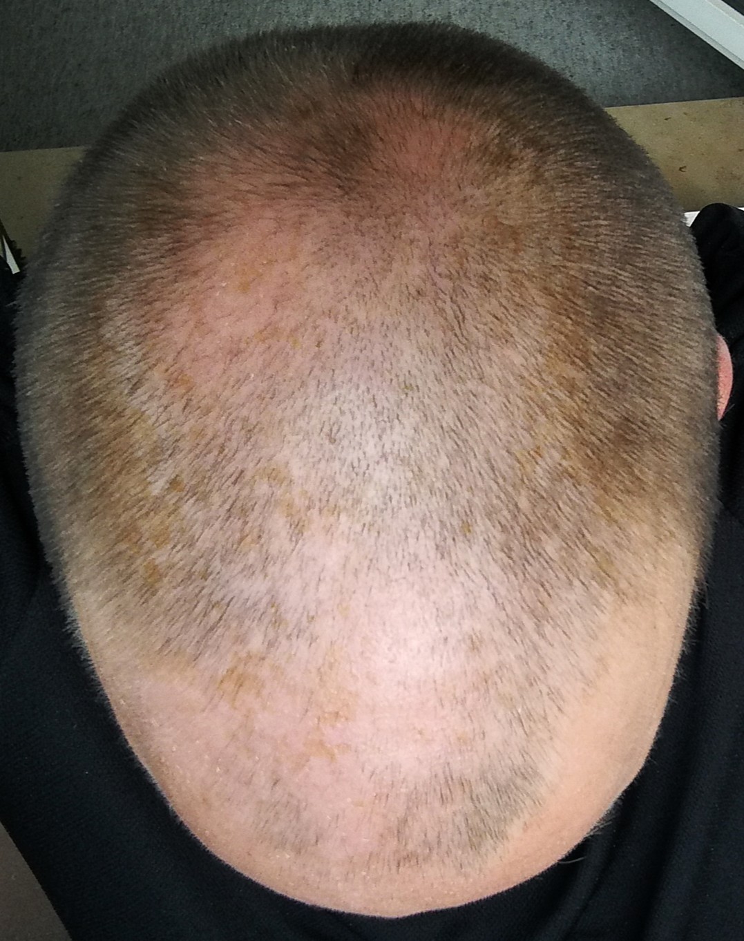 /fud/index.php/fa/30300/0/