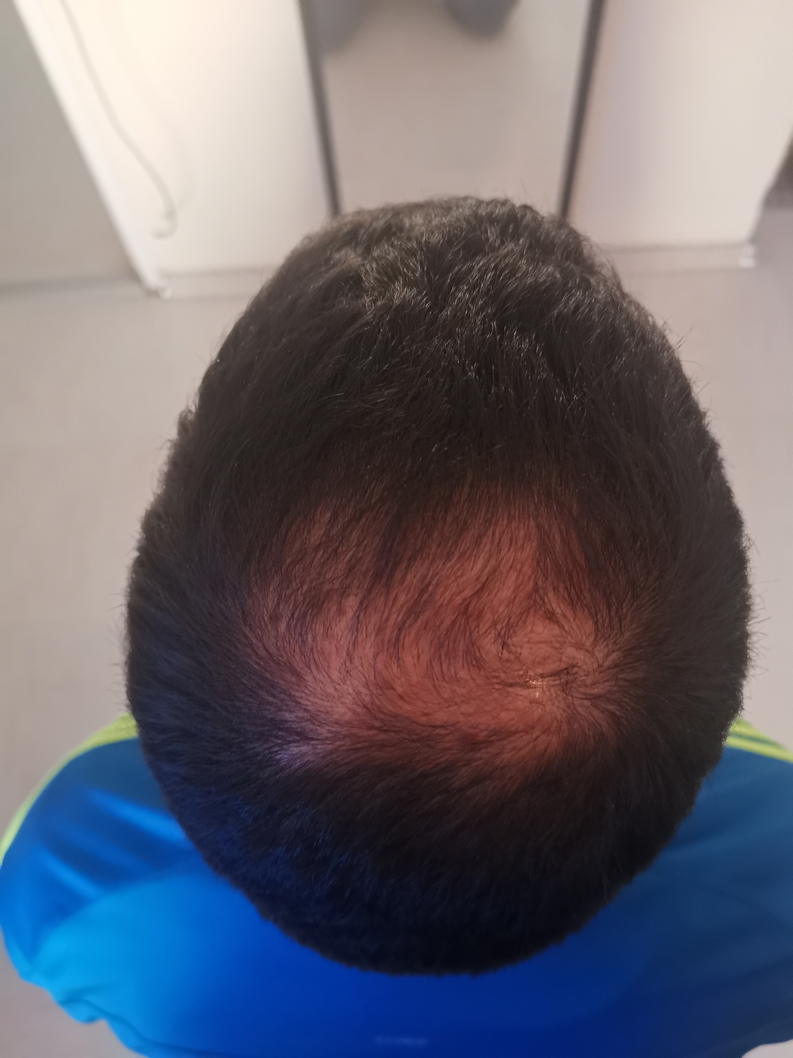 /fud/index.php/fa/31153/0/