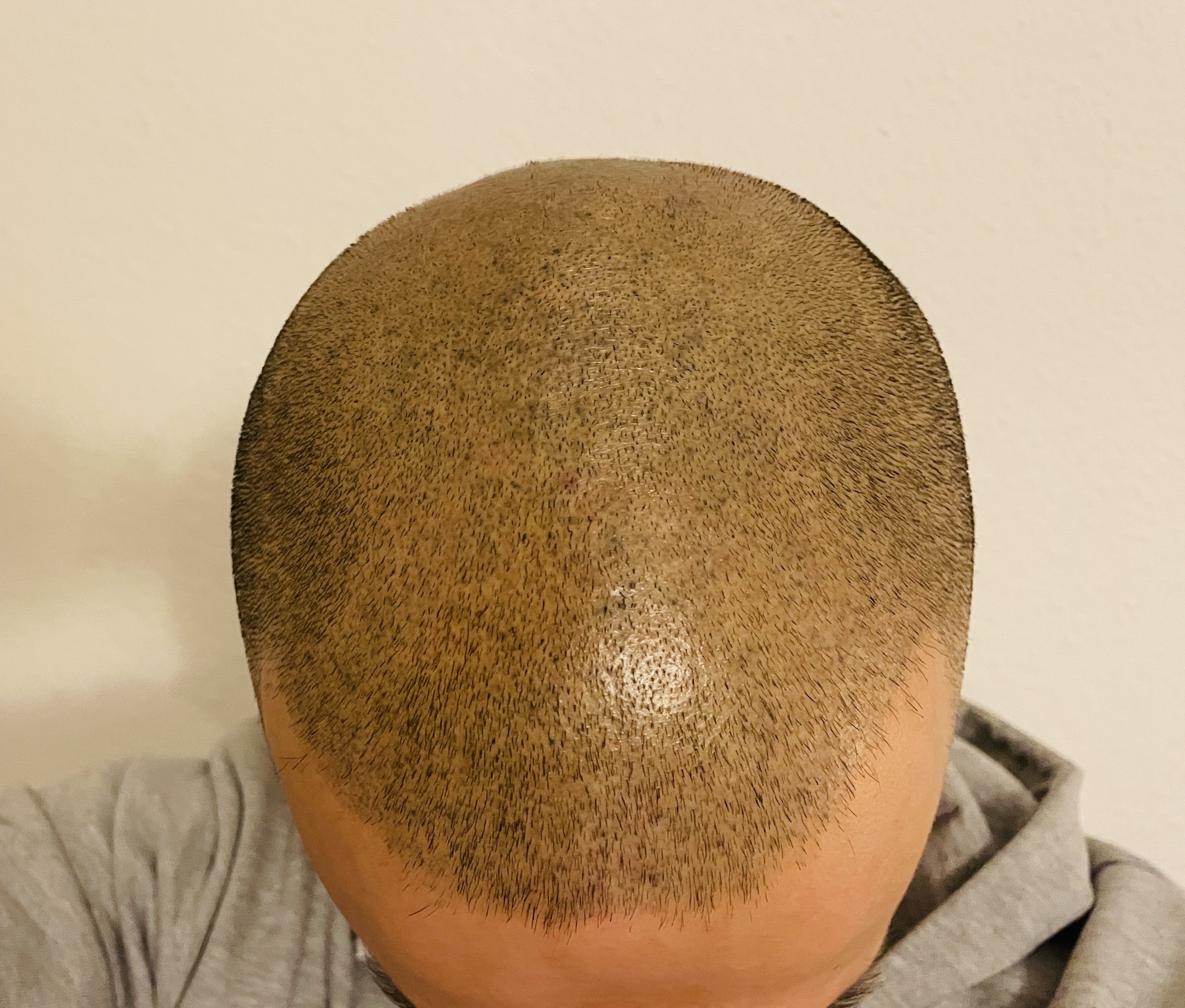 /fud/index.php/fa/31253/0/