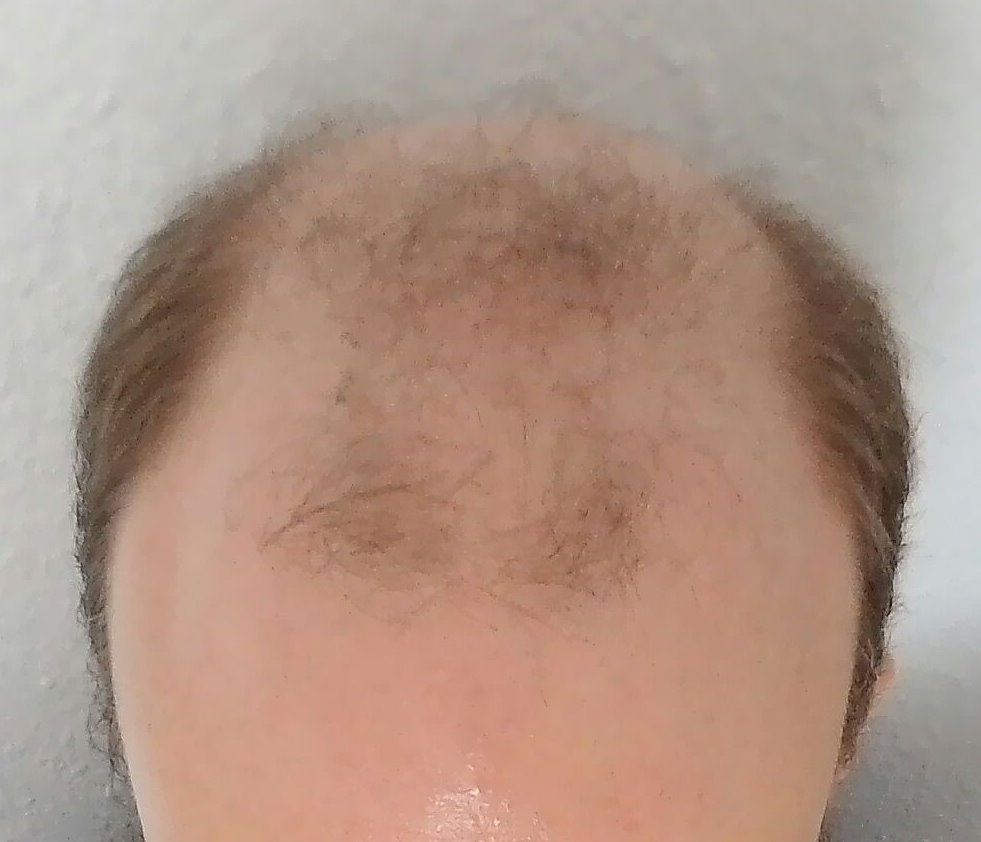 /fud/index.php/fa/31822/0/