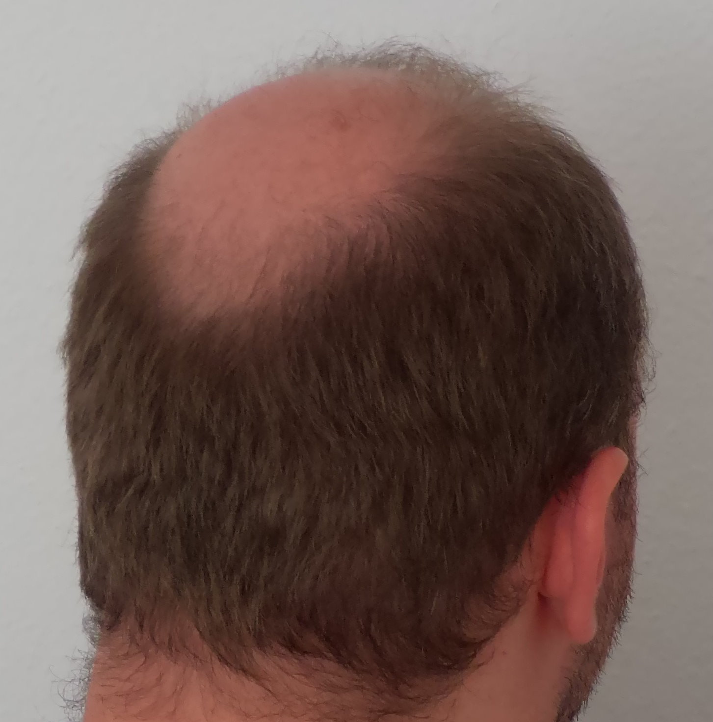 /fud/index.php/fa/31823/0/