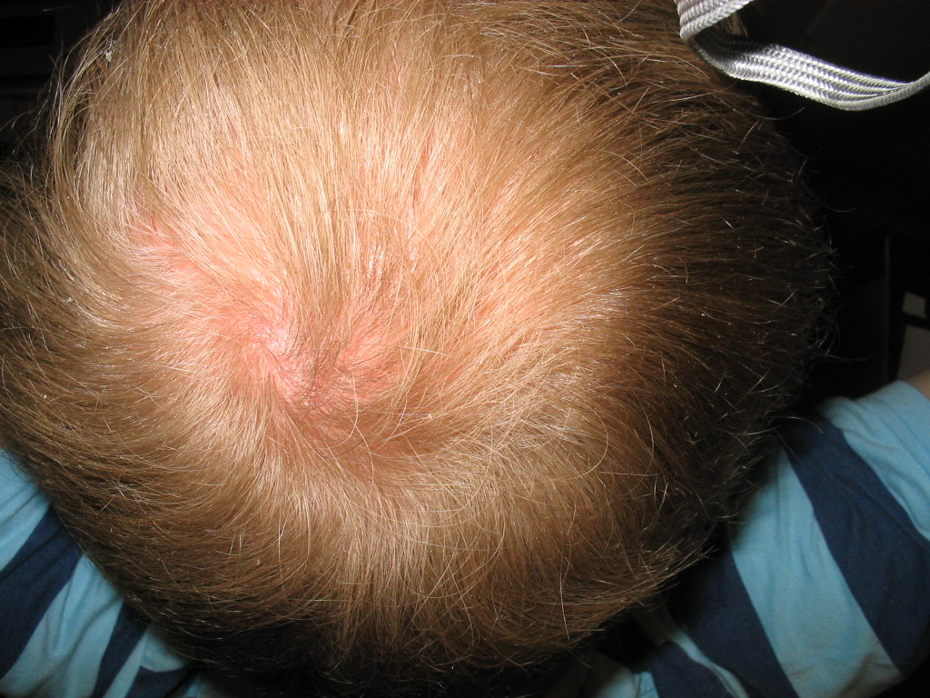 index.php/fa/3210/0/