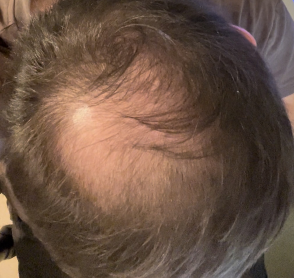 /fud/index.php/fa/32825/0/