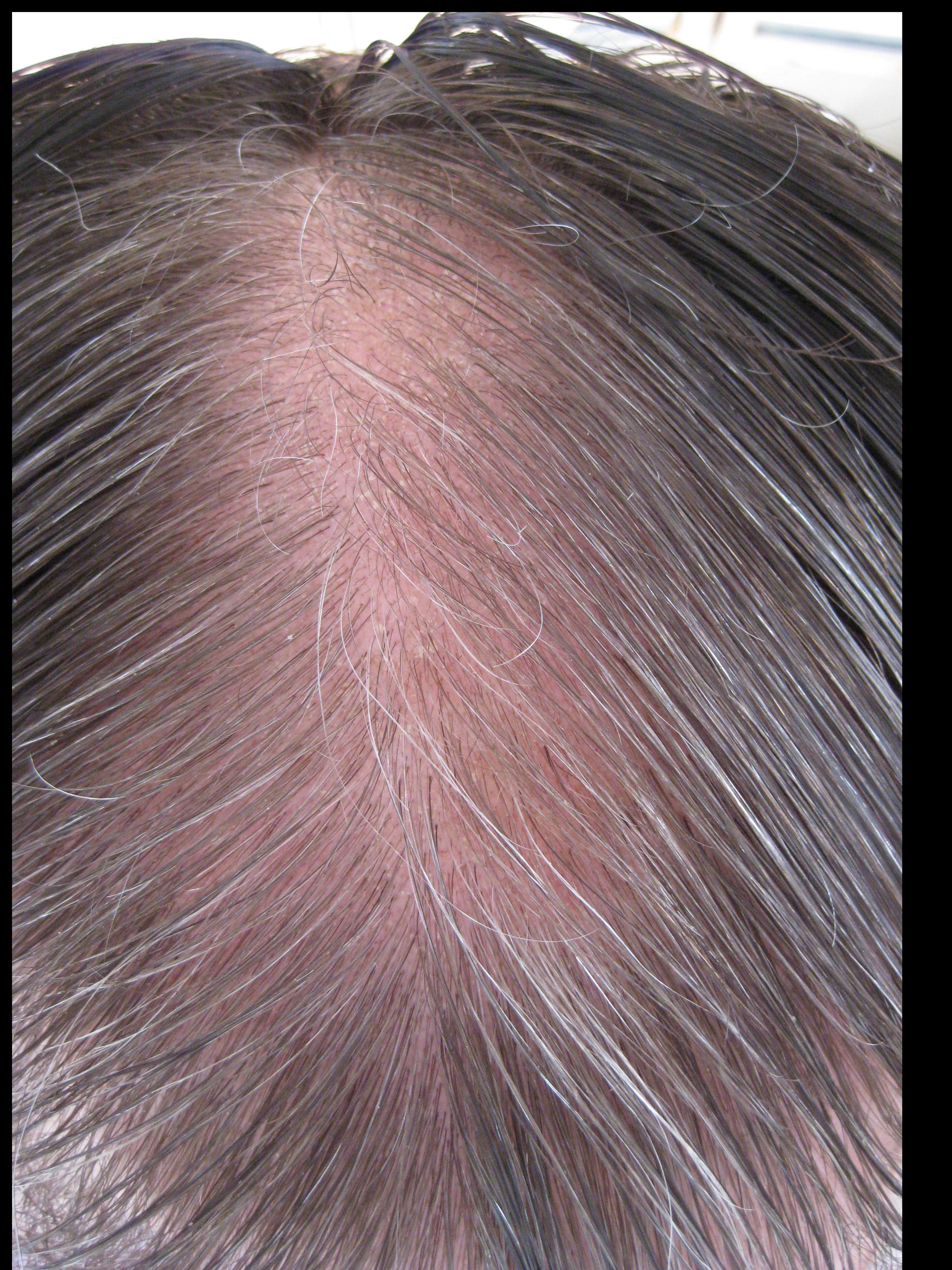 /fud/index.php/fa/32849/0/