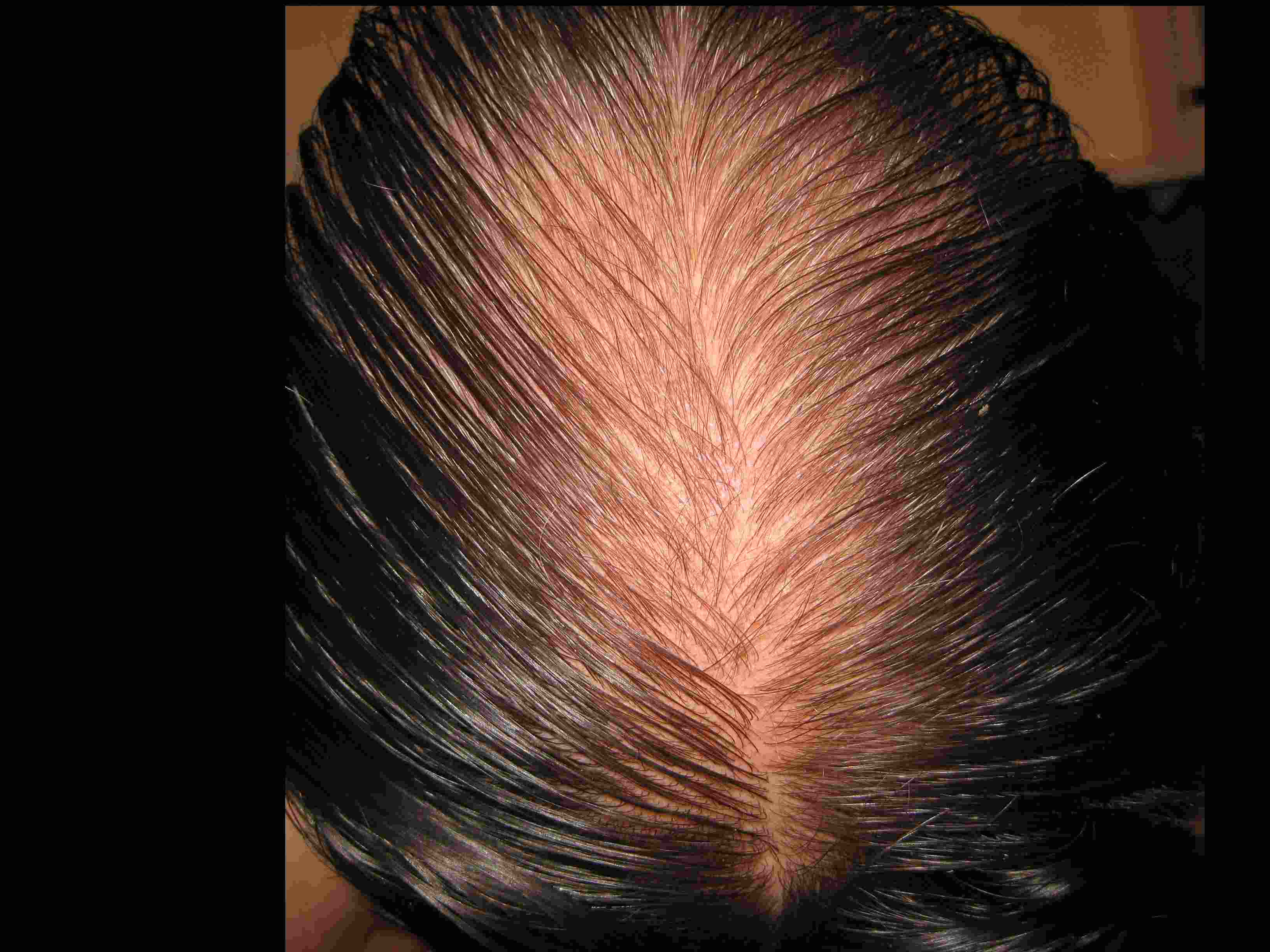 /fud/index.php/fa/33138/0/