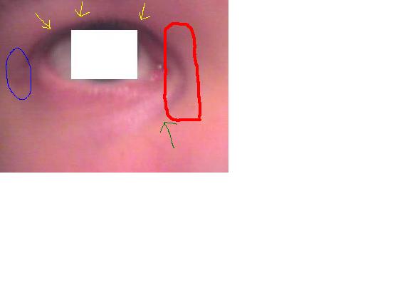 index.php/fa/3331/0/