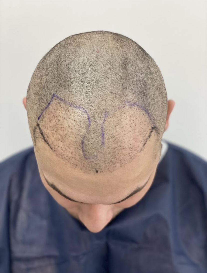 /fud/index.php/fa/33713/0/