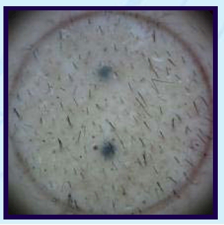 index.php/fa/3391/0/