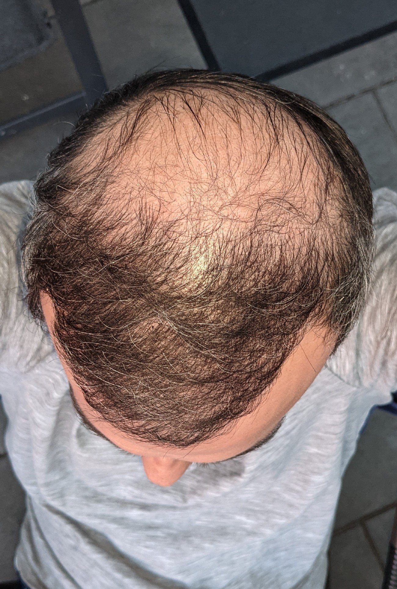 /fud/index.php/fa/34049/0/