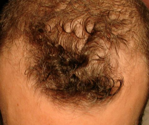 index.php/fa/3412/0/