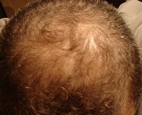 index.php/fa/3414/0/