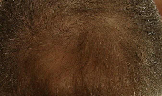 index.php/fa/3415/0/