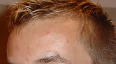 index.php/fa/3491/0/