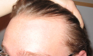 index.php/fa/3510/0/