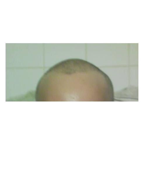 index.php/fa/3533/0/