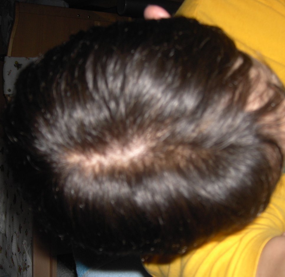 index.php/fa/3541/0/