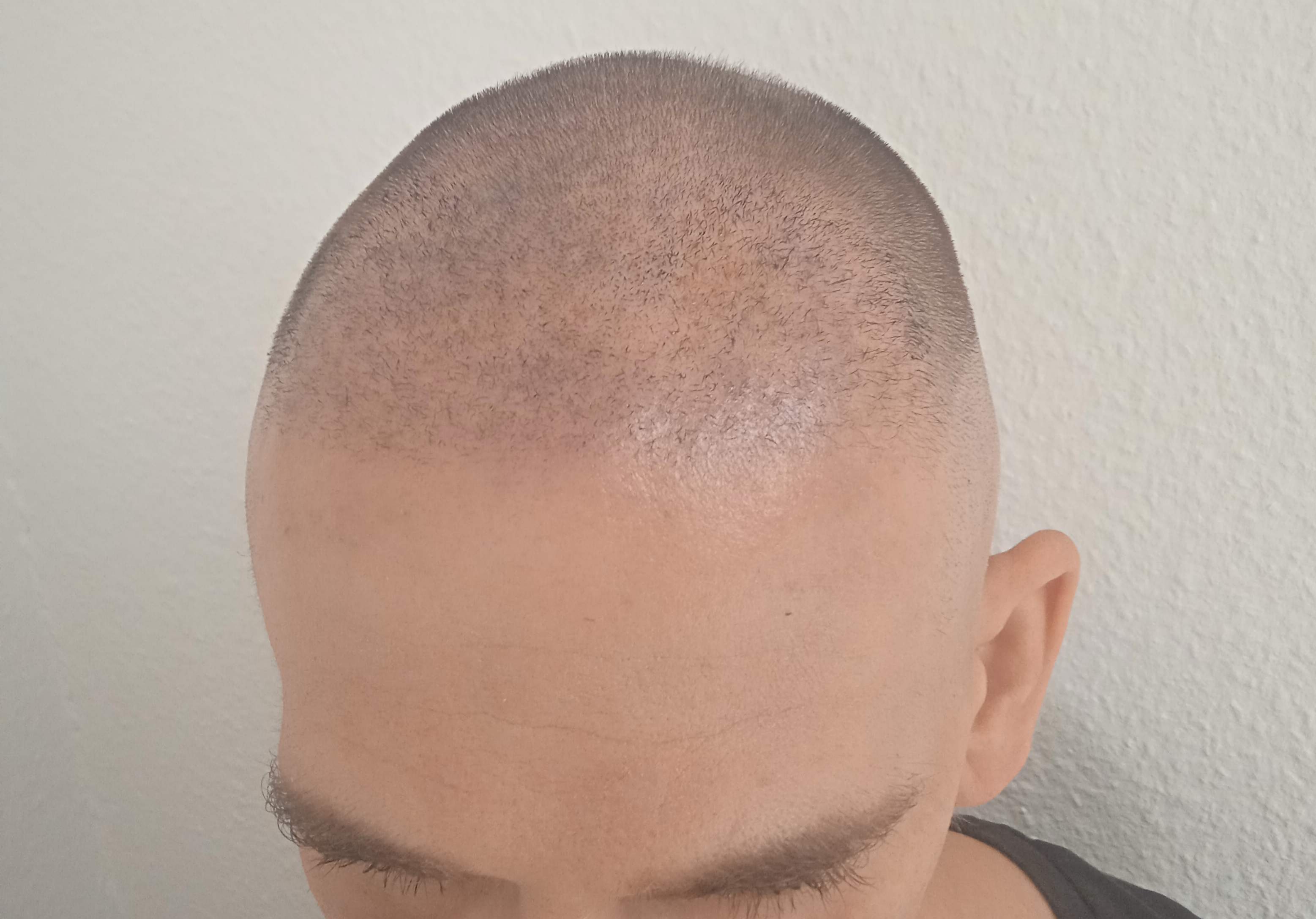 /fud/index.php/fa/35877/0/