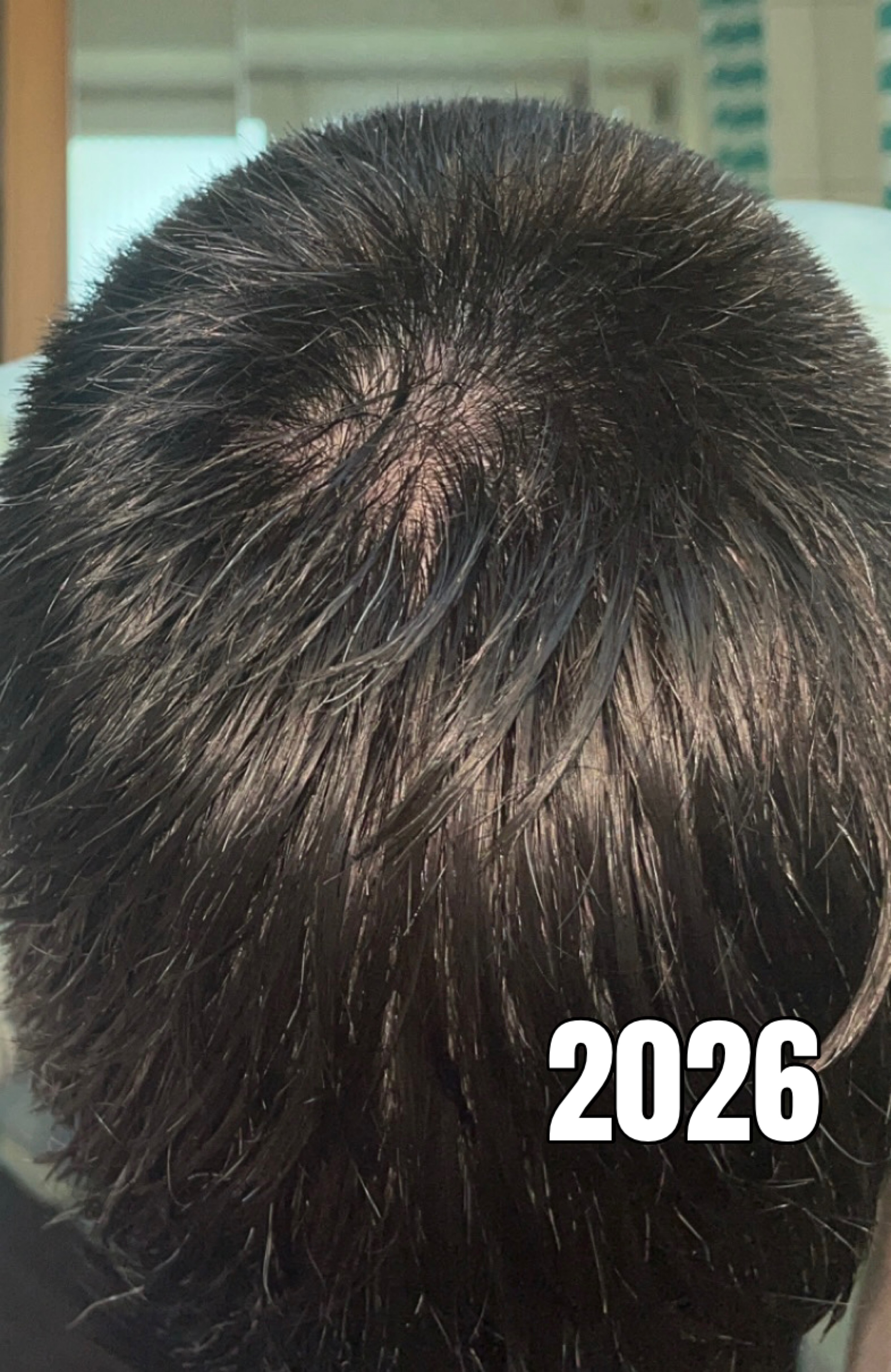 /fud/index.php/fa/36284/0/