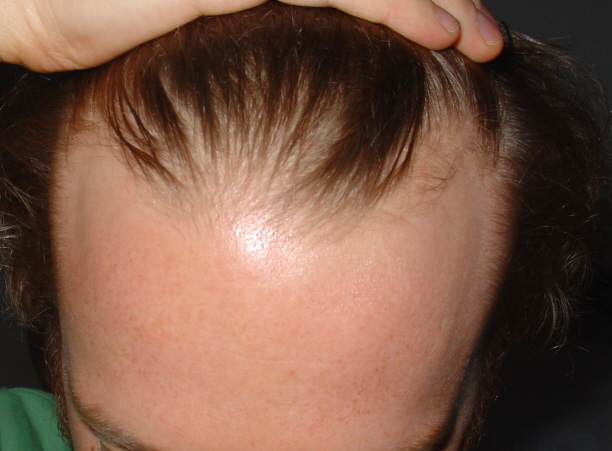 index.php/fa/3689/0/