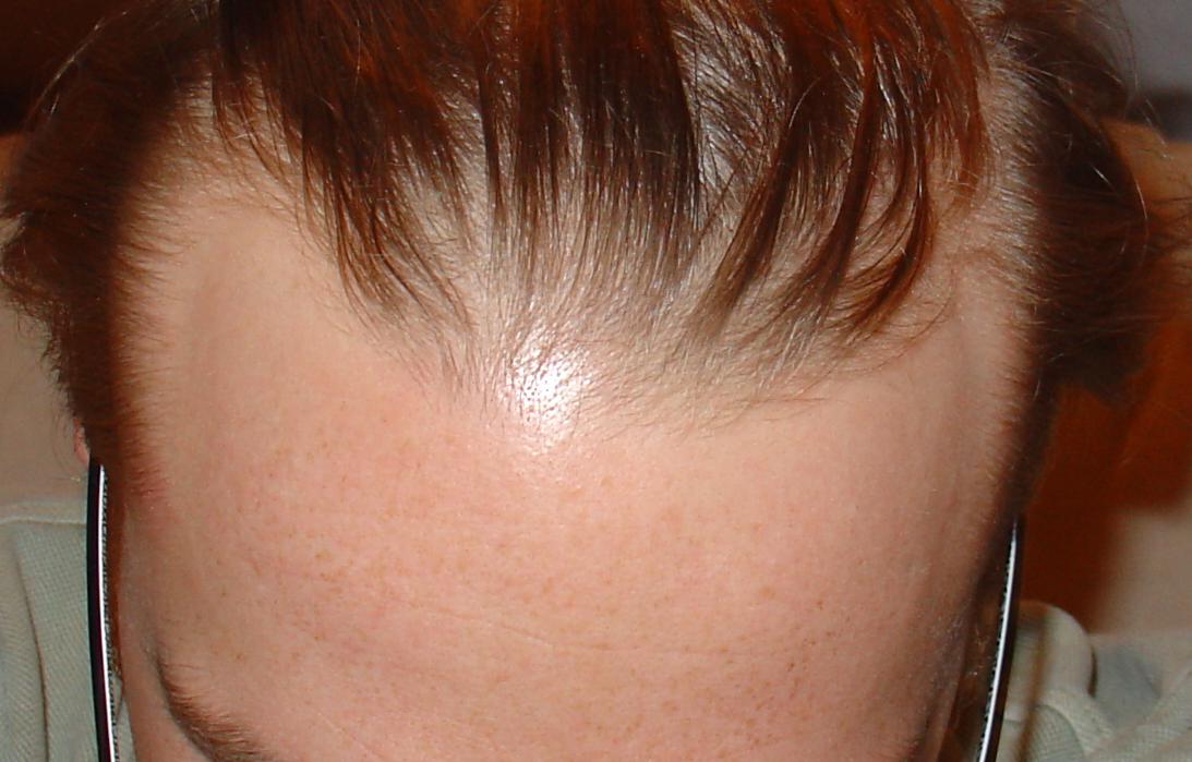 index.php/fa/3690/0/