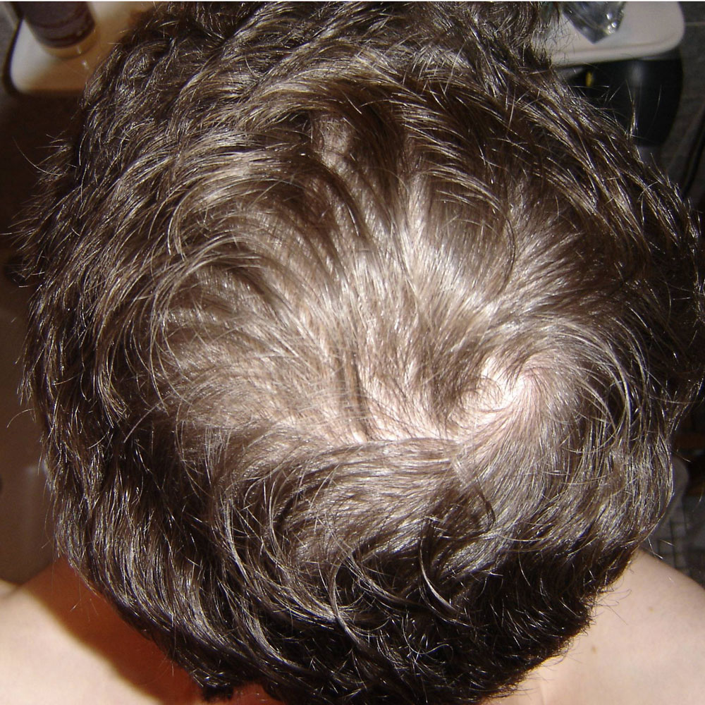 index.php/fa/3793/0/