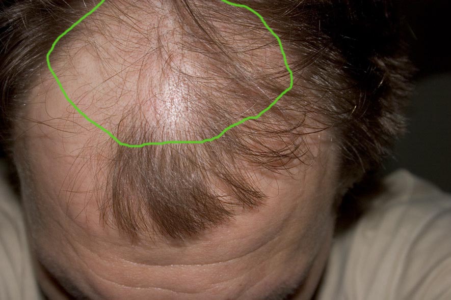 index.php/fa/3867/0/