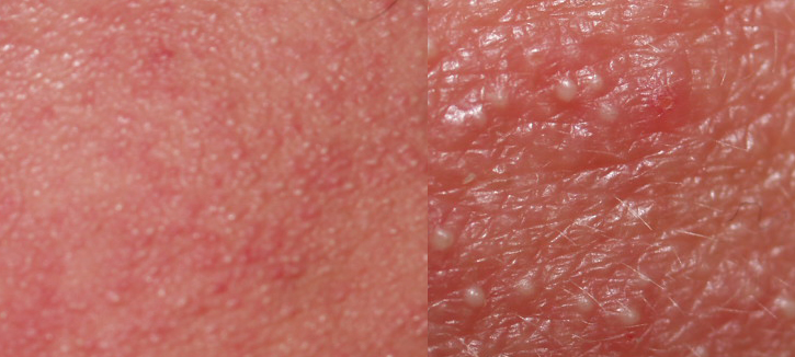 index.php/fa/3881/0/