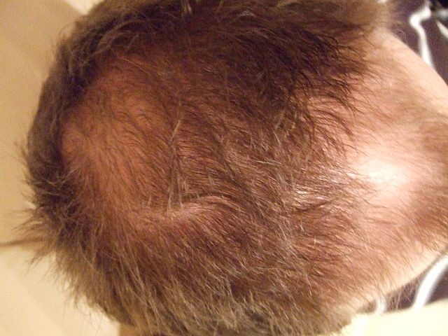 index.php/fa/3996/0/