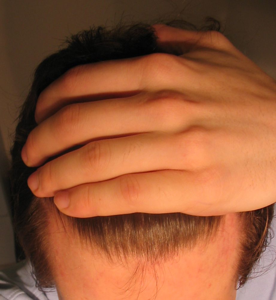 index.php/fa/4025/0/