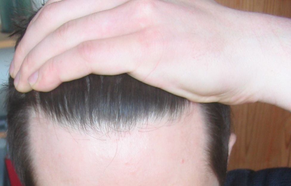 index.php/fa/4026/0/