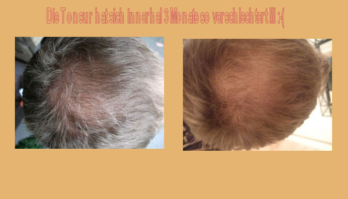 index.php/fa/4147/0/