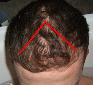 index.php/fa/4163/0/