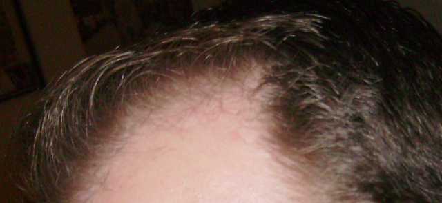 index.php/fa/4213/0/