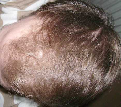 index.php/fa/4214/0/