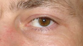 index.php/fa/4452/0/