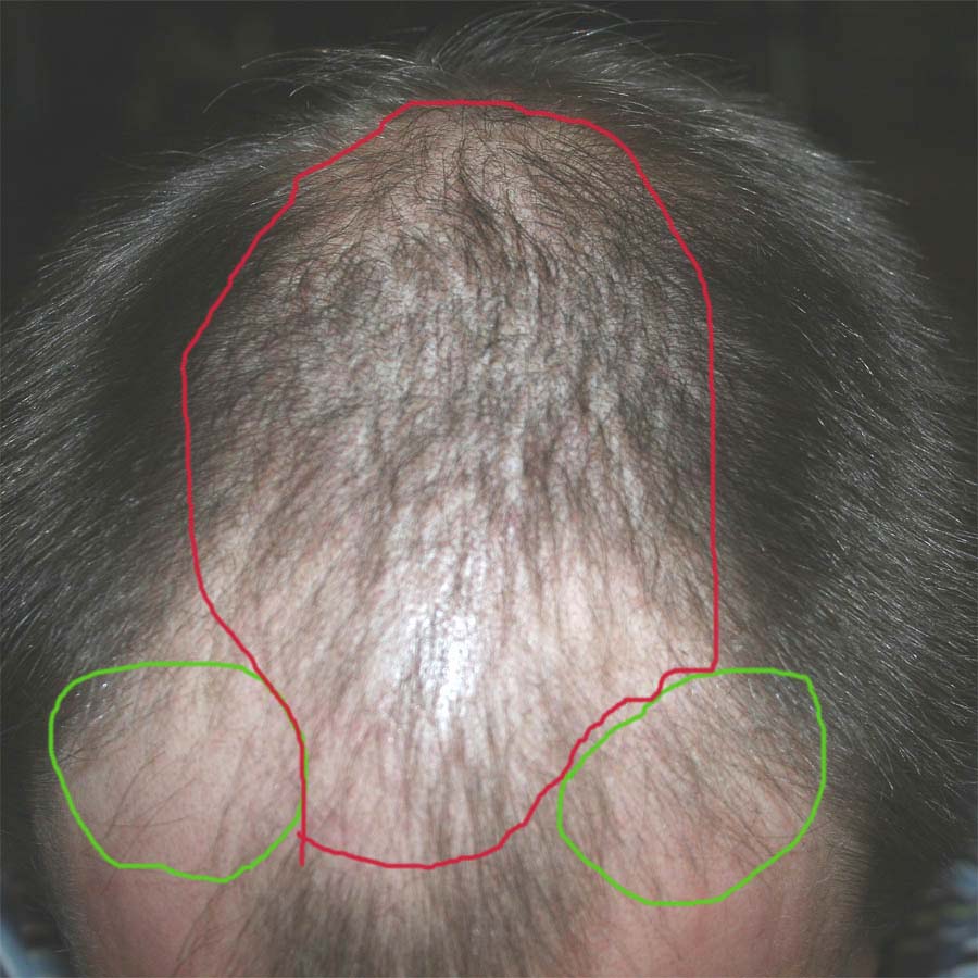 index.php/fa/4504/0/