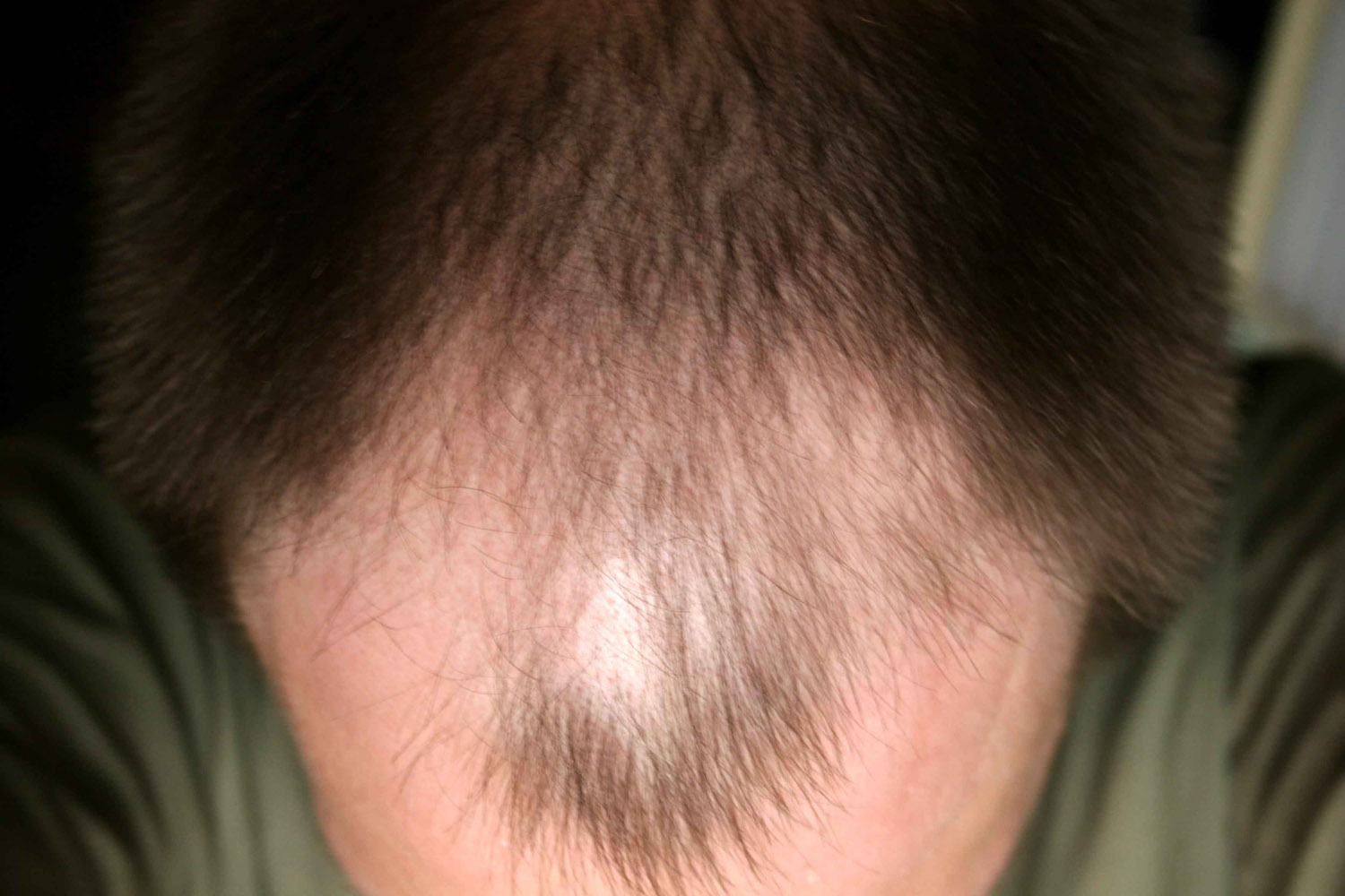 index.php/fa/4509/0/