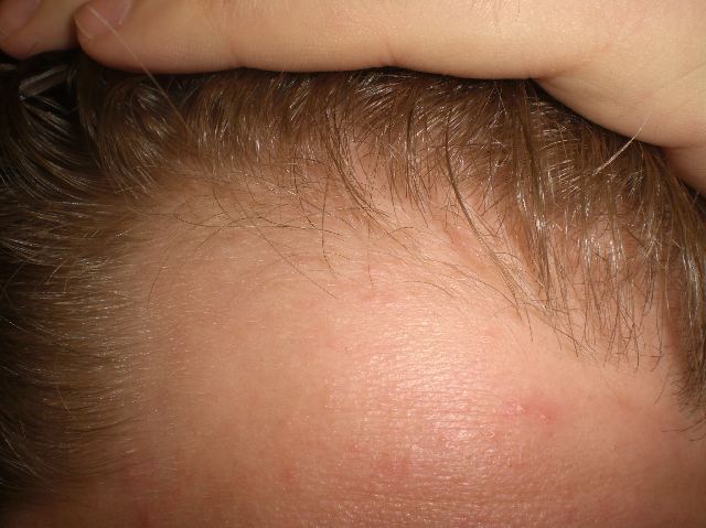 index.php/fa/4524/0/