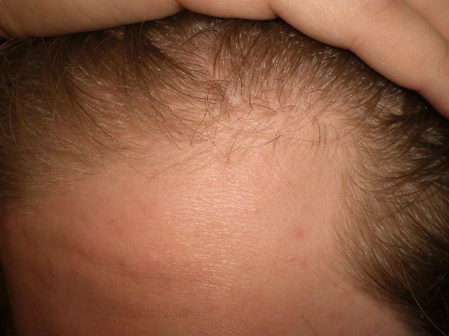 index.php/fa/4525/0/